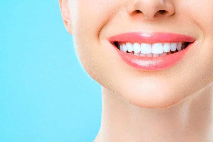 Blanchiment des dents Montréal