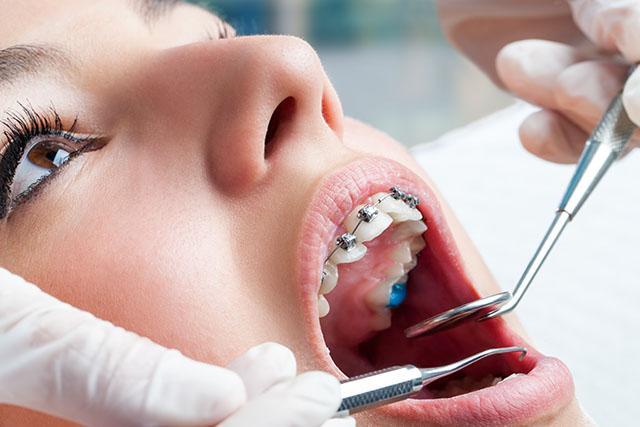Traitement endodontique Montréal